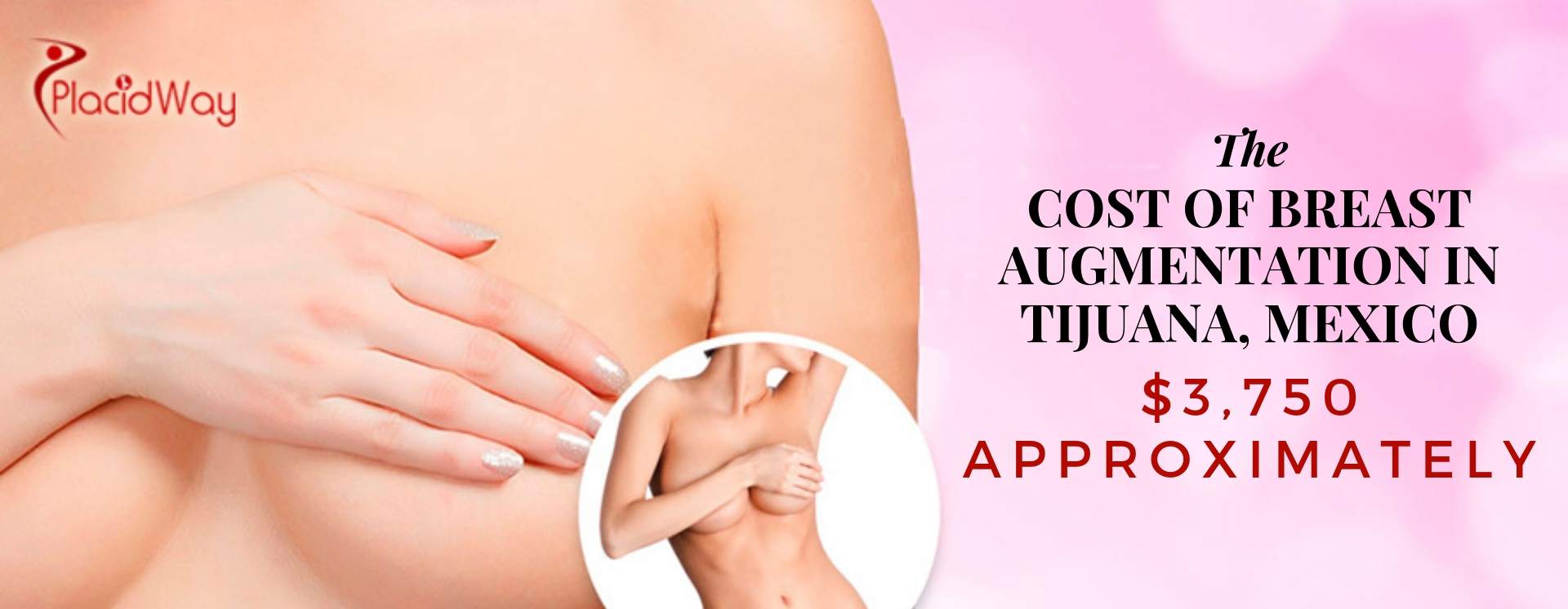 Best Breast Augmentation in Tijuana Mexico